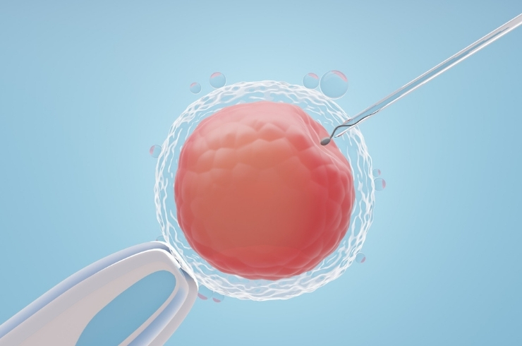 IVF & Assisted Reproductive Technology (ART)